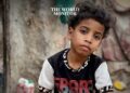 Children in Yemen “Suffering”