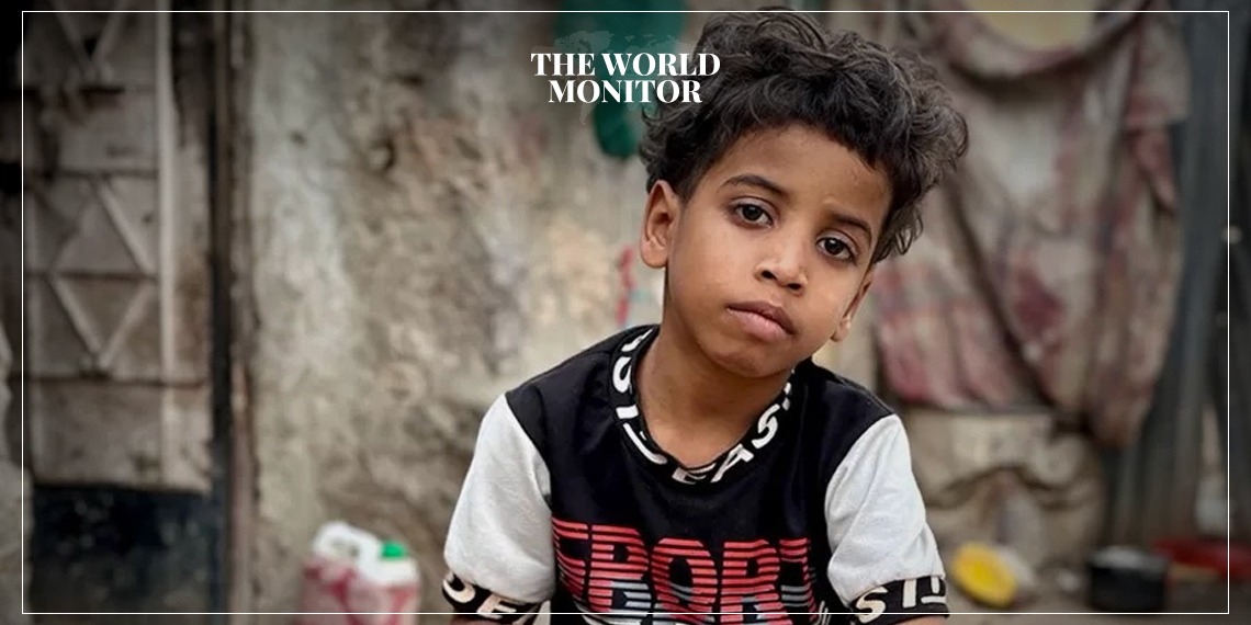 Children in Yemen “Suffering”
