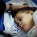 Italy to Treat 100 Children from Gaza