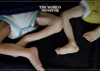 Child Malnutrition Reaches Crisis Levels in North Gaza