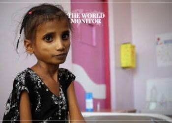 10 Million Children Suffer from Malnutrition in Yemen