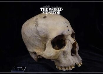 Ancient Egyptians Performed Cancer Surgery 4000 Years Ago