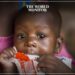 52,000 Children in Zambia at Risk of Malnutrition