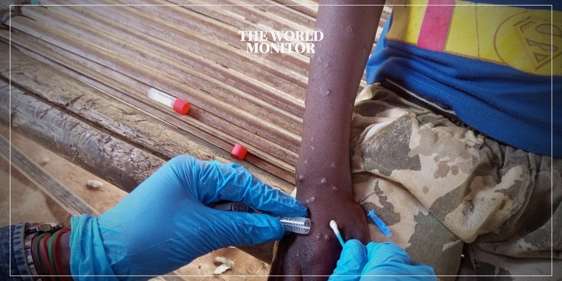 IOM Seeks $18.5M for African Disease Outbreak Response