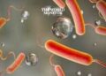 Egypt on High Readiness to Combat Cholera from Sudan