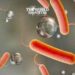 Egypt on High Readiness to Combat Cholera from Sudan