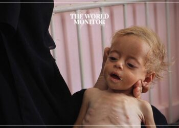 77 Million Children in Middle East Suffer from Malnutrition