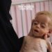 77 Million Children in Middle East Suffer from Malnutrition
